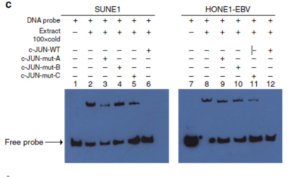 miR-3188 regulates nasopharyngeal carcinoma proliferation and chemosensitivity through aFOXO1-modulated positive feedback loop with mTORCp-PI3K/AKT-c-JUN