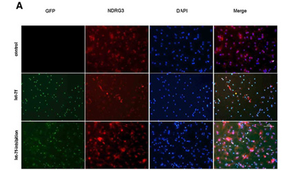 Let-7f Regulates the Hypoxic Response in Cerebral Ischemia by Targeting NDRG3