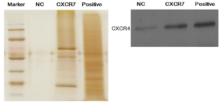 The potential role of stromal cell-derived factor-1/CXCR4/ CXCR7 axis in adipose-derived mesenchymal stem cells