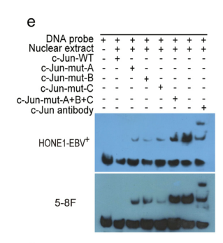 Cinobufotalin powerfully reversed EBV-miR-BART22-induced cisplatin resistance via stimulating MAP2K4 to antagonize non-muscle myosin heavy chain IIA/glycogen synthase 3/-catenin signaling pathway
