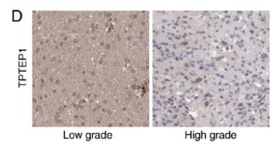lncRNA TPTEP1 inhibits stemness and radioresistance of  glioma through miR?106a?5p?mediated P38 MAPK signaling