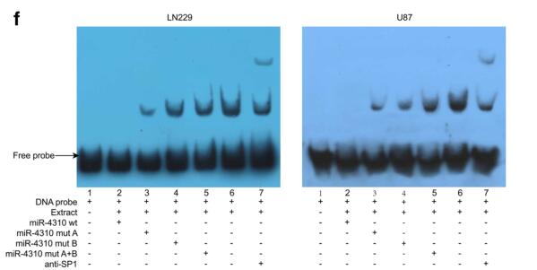 MiR-4310 induced by?SP1 targets PTEN  to?promote glioma progression