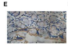 An NF-kBCdriven lncRNA orchestrates colitis  and circadian clock