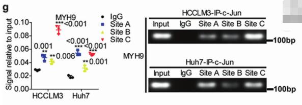 Silencing MYH9 blocks HBx-induced GSK3 ubiquitination and degradation to inhibit tumor stemness in hepatocellular carcinoma
