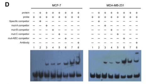 Timeless-Stimulated miR-5188-FOXO1/-Catenin-c-Jun Feedback Loop Promotes Stemness via Ubiquitination of -Catenin in Breast Cancer