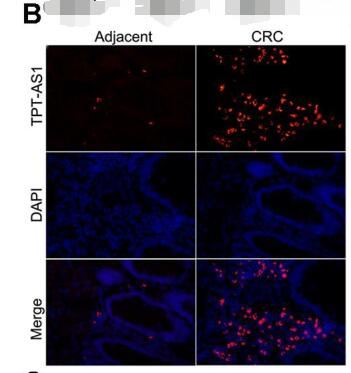 Long noncoding RNA TPT1-AS1 promotes the progression and metastasis of colorectal cancer by upregulating the TPT1-mediated FAK and JAK-STAT3 signalling pathways