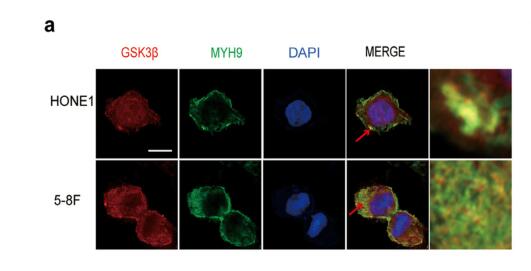 Cinobufotalin powerfully reversed EBV-miR-BART22-induced cisplatin resistance via stimulating MAP2K4 to antagonize non-muscle myosin heavy chain IIA/glycogen synthase 3/-catenin signaling pathway