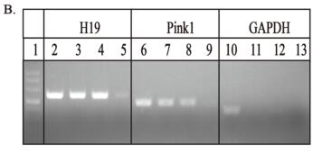 LncRNA H19 governs mitophagy and restores mitochondrial respiration in the heart through Pink1/Parkin signaling during obesity