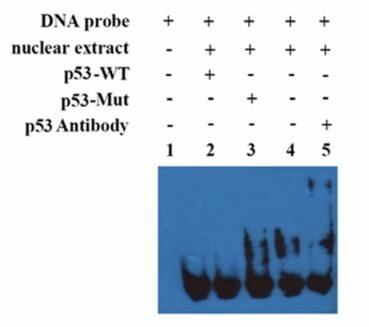 VPS33B interacts with NESG1 to suppress cell growth and cisplatin chemoresistance in ovarian cancer