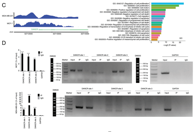 Long non?coding RNA DANCR aggravates breast cancer through the miR?34c/E2F1 feedback loop