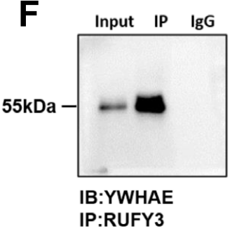 circSORBS1 inhibits lung cancer progression by sponging miR-6779-5p and directly binding RUFY3 mRNA
