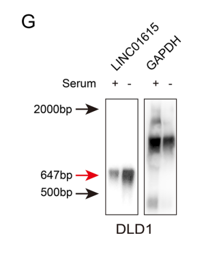 LINC01615 maintains cell survival in adaptation to nutrient starvation through the pentose phosphate pathway and modulates chemosensitivity in colorectal cancer