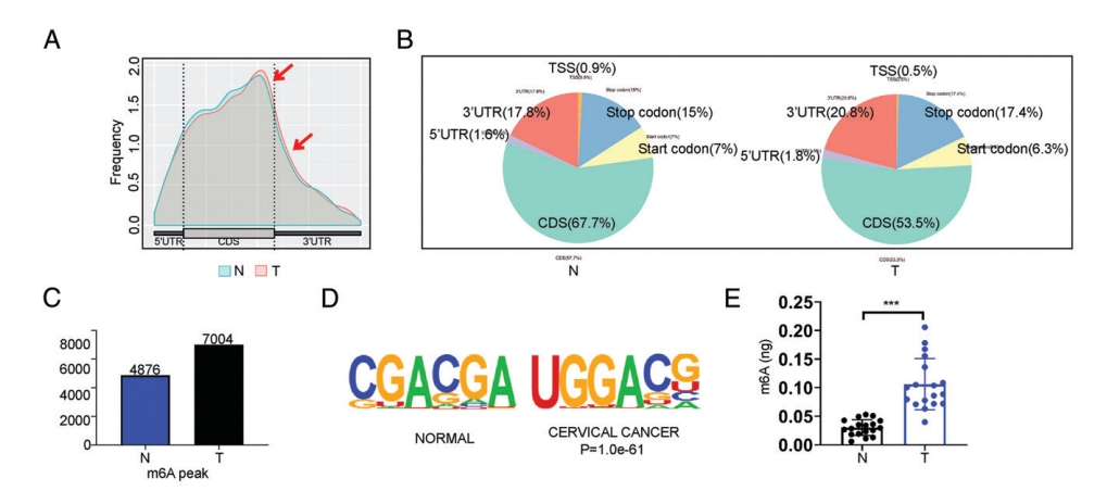 Glycolysis Induced by METTL14 Is Essential for Macrophage Phagocytosis and Phenotype in Cervical Cancer