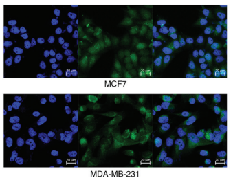 Long non?coding RNA DANCR aggravates breast cancer through the miR?34c/E2F1 feedback loop