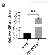 circSKA3 promotes colorectal cancer metastases through miR-1238 and methylation